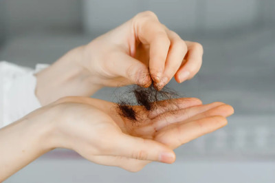 Hair Loss in Summer and Sweating (My Personal Experience)